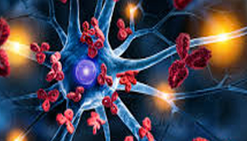 Study Finds Comorbidities Increased Disease Activity in Multiple Sclerosis