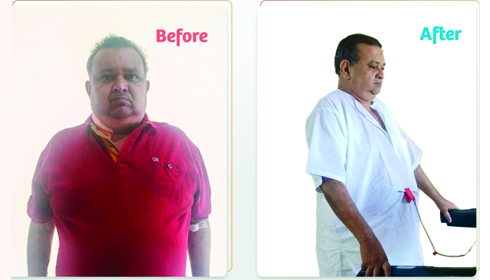 Jayeshkumar Jani, The Patient Pre & Post Operation