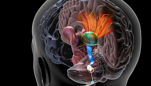 India's First 'Brain Pacemaker' Surgery Brings New Hope