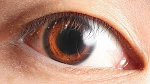 NIH Develops Eye Drops That May Slow Vision Loss in Retinitis Pigmentosa